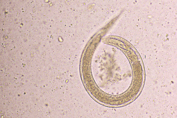 istock Strongyloides stercoralis 1692368381