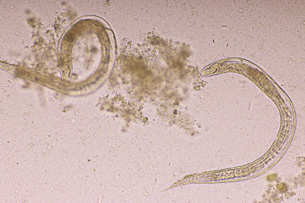 istock Strongyloides stercoralis 1692369070