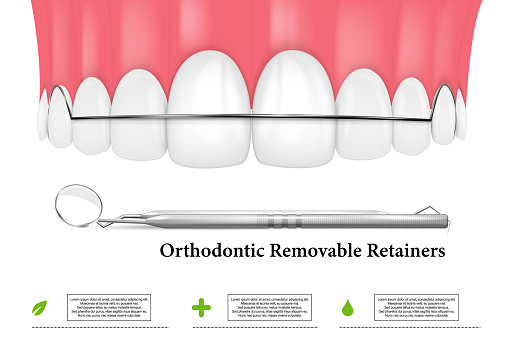3d render of jaw with orthodontic removable retainer over whte background.