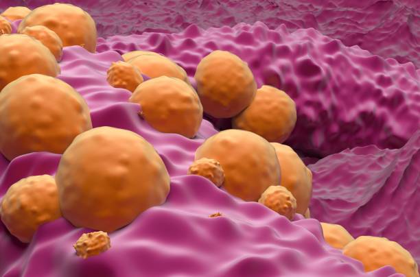 basal-cell carcinoma (bcc) - closeup view 3d illustration - basalcellscancer bildbanksfoton och bilder