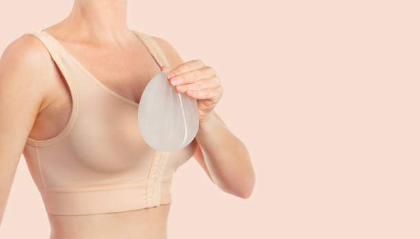 женщина носит компрессионный бюстгальтер после увеличения груди. удержание имплантатов - people cleavage color image clothing стоковые фото и изображения