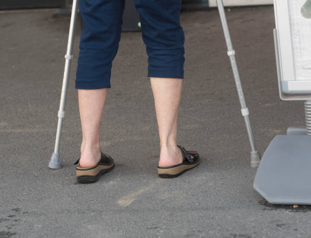 istock foot injury after an accident 1696798011