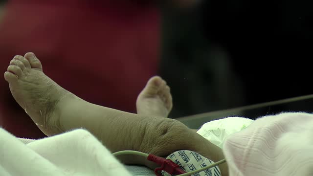 Premature Baby at Neonatal Intensive Care Unit in Hospital. Closeup. 4K Resolution.