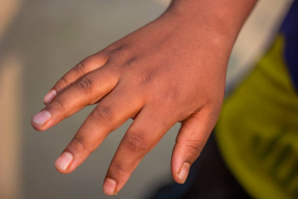 istock A boy with five fingers on his hand and blurred background 1698286876