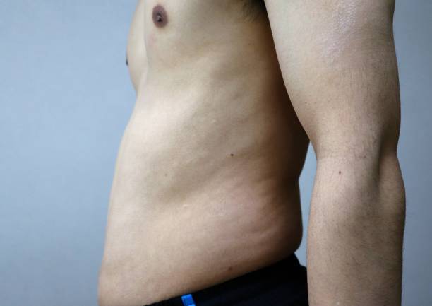 istock Japanese man with belly fat 1698601482