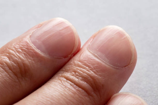 istock Macro photo of vertical ridges in fingernails 1698610372