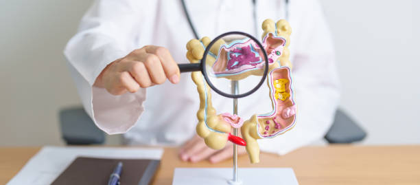 medico con modello di anatomia del colon umano e lente d'ingrandimento. malattia del colon, intestino crasso, cancro del colon-retto, colite ulcerosa, diverticolite, sindrome dell'intestino irritabile e apparato digerente - chaos foto e immagini stock