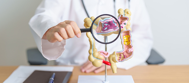 Doctor with human Colon anatomy model and magnifying glass. Colonic disease, Large Intestine, Colorectal cancer, Ulcerative colitis, Diverticulitis, Irritable bowel syndrome and Digestive system