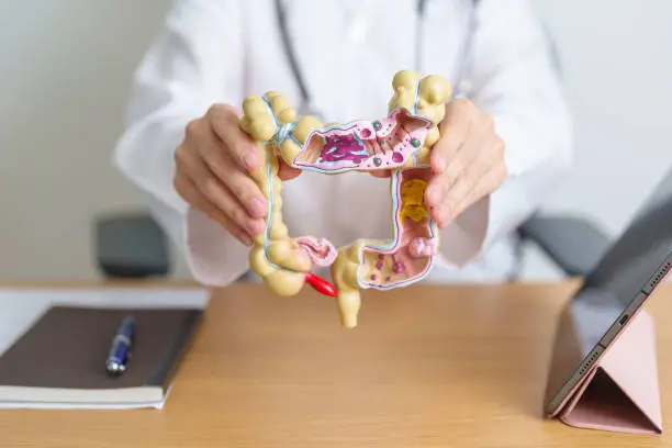Photo of Doctor with human Colon anatomy model and tablet. Colonic disease, Large Intestine, Colorectal cancer, Ulcerative colitis, Diverticulitis, Irritable bowel syndrome and Digestive system