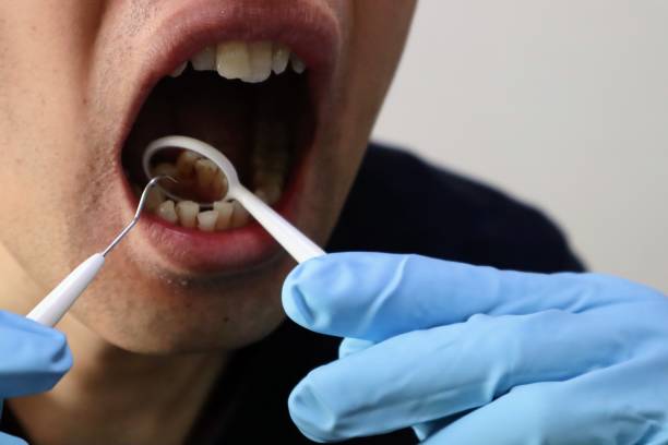 istock Image of dental treatment 1698735116