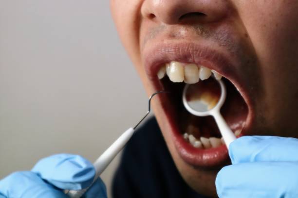 istock Image of dental treatment 1698735125