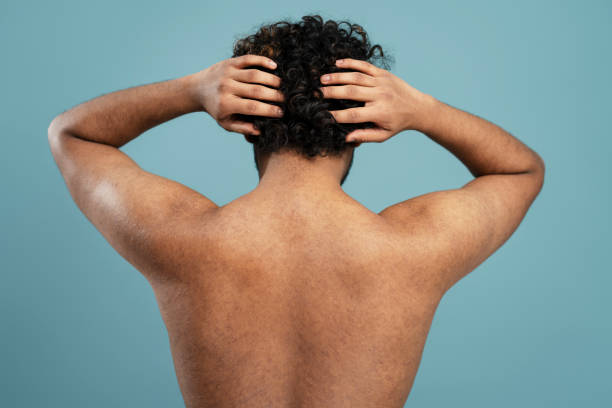 Rear view shirtless dark-haired curly man scratching head or massaging head skin on blue background Young shirtless dark-haired curly man scratching head or massaging head skin standing back to the camera, isolated on blue background. Skin, body and hair care concept. Male beauty portrait dandruff men stock pictures, royalty-free photos & images