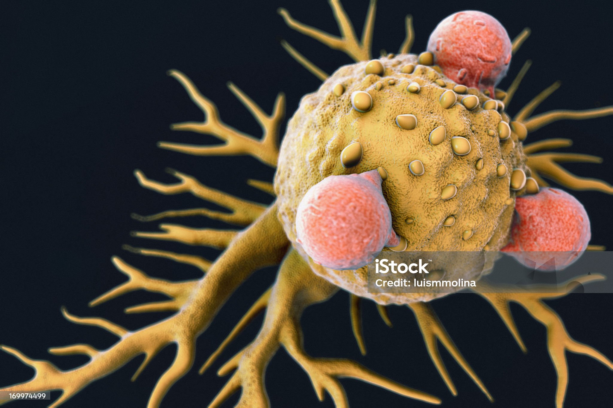 T Lymphocytes and Cancer Cell T lymphocytes attached to a cancer cell artwork. Cancer Cell Stock Photo