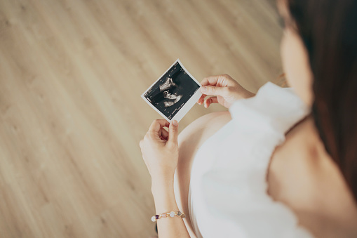The pregnant woman holds the ultrasound scan photo of her unborn child with joy, eagerly anticipating both the arrival of her baby and this precious gift.
