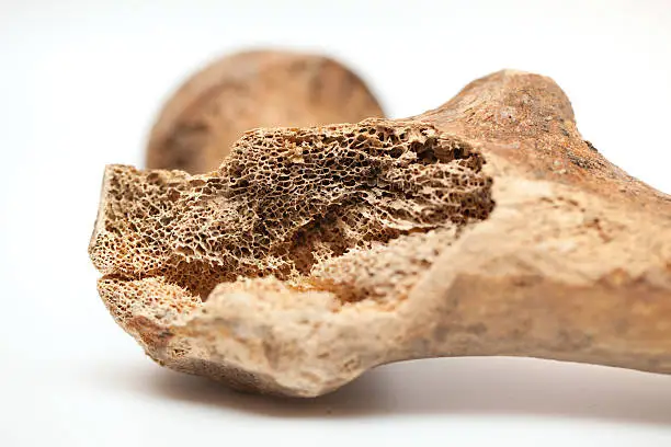 Photo of Human bone texture