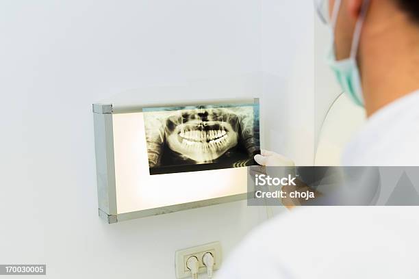 Dentista Es El Examen De Rayos X De Los Dientes Foto de stock y más banco de imágenes de Asistencia sanitaria y medicina - Asistencia sanitaria y medicina, Datos, Dentista