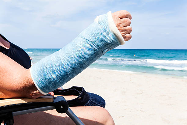 医療: 夏季には、骨折した腕 - ギプス ストックフォトと画像