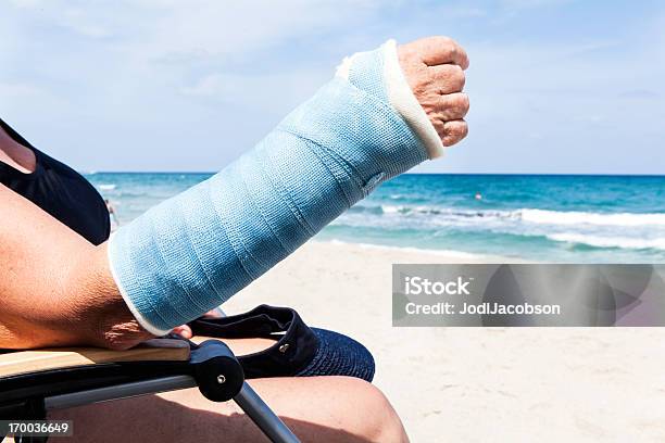 Medyczne Złamana Ręka W Lecie - zdjęcia stockowe i więcej obrazów Wakacje - Wakacje, Gips - Sprzęt ortopedyczny, Plaża