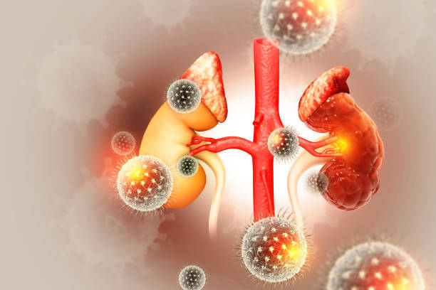 istock Bacteria or virus infected human kidney on scientific background. Kidney disease. 3d illustration 1700488185