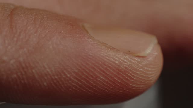 Macro Close up of discolored man's fingernail on index finger