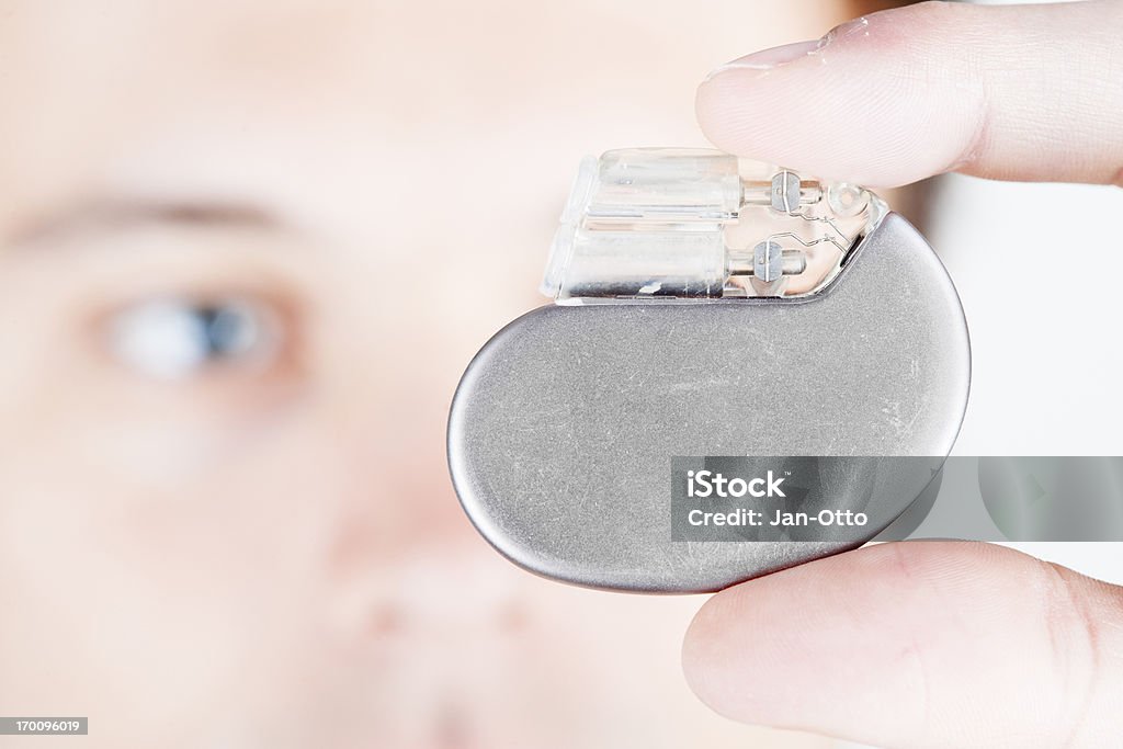 Large Pacemaker Photo Cardiac Pacemaker Stock Photo - Download Image Now - Pacemaker, Cardiac ...