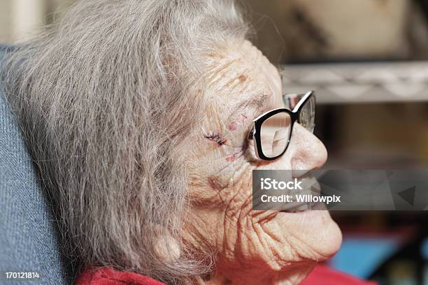 Starszy Kobieta Uraz Głowy - zdjęcia stockowe i więcej obrazów Szwy - Szwy, Uraz fizyczny, 80-89 lat