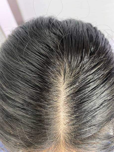 istock Head and hair old young 1701410228