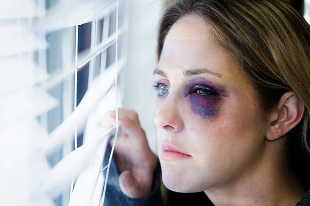 istock Woman with a Black Eye 170145246