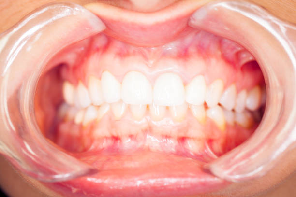 detail shot of a woman's teeth
