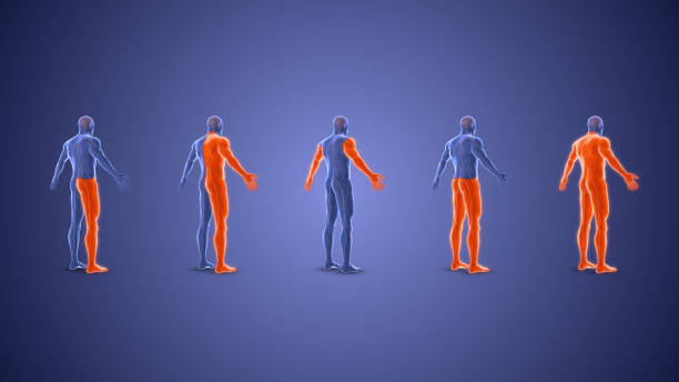 istock Different types of paralysis condition medical concept 1701678259