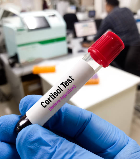 Cortsisol Collection Sample 40+ Hydrocortisone Photos Stock Photos, Pictures & Royalty-Free Images ...