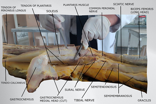 the anatomy of back of leg (flexor compartment) and lower back region of thigh (hamstring). comprises related muscles, nerves, fossa and tendons.
