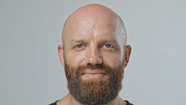 istock Sad bald man with red head beard. White teeth. Redhead guy face portrait 1702201741