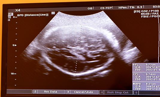 Ultrasonography on the uterus of a pregnant woman showing a healthy fetus, maternal ultrasound during pregnancy, pregnancy follow up and fetus health concept, ultrasonogram medical checkup, selective focus
