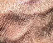 Wrinkled skin texture