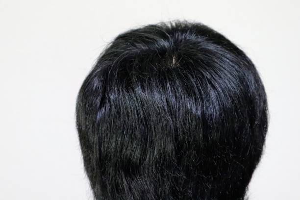 istock Japanese men's back hair 1704281268