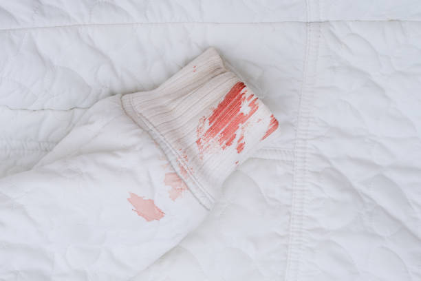 istock Bloody stains on a white clothes 1704439276