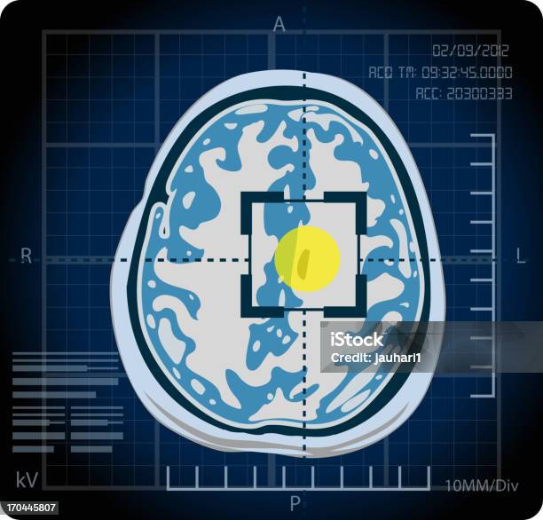 Mri Lokalizacja - Stockowe grafiki wektorowe i więcej obrazów Obrazowanie magnetyczno-rezonansowe - Obrazowanie magnetyczno-rezonansowe, Anatomia człowieka, Badania