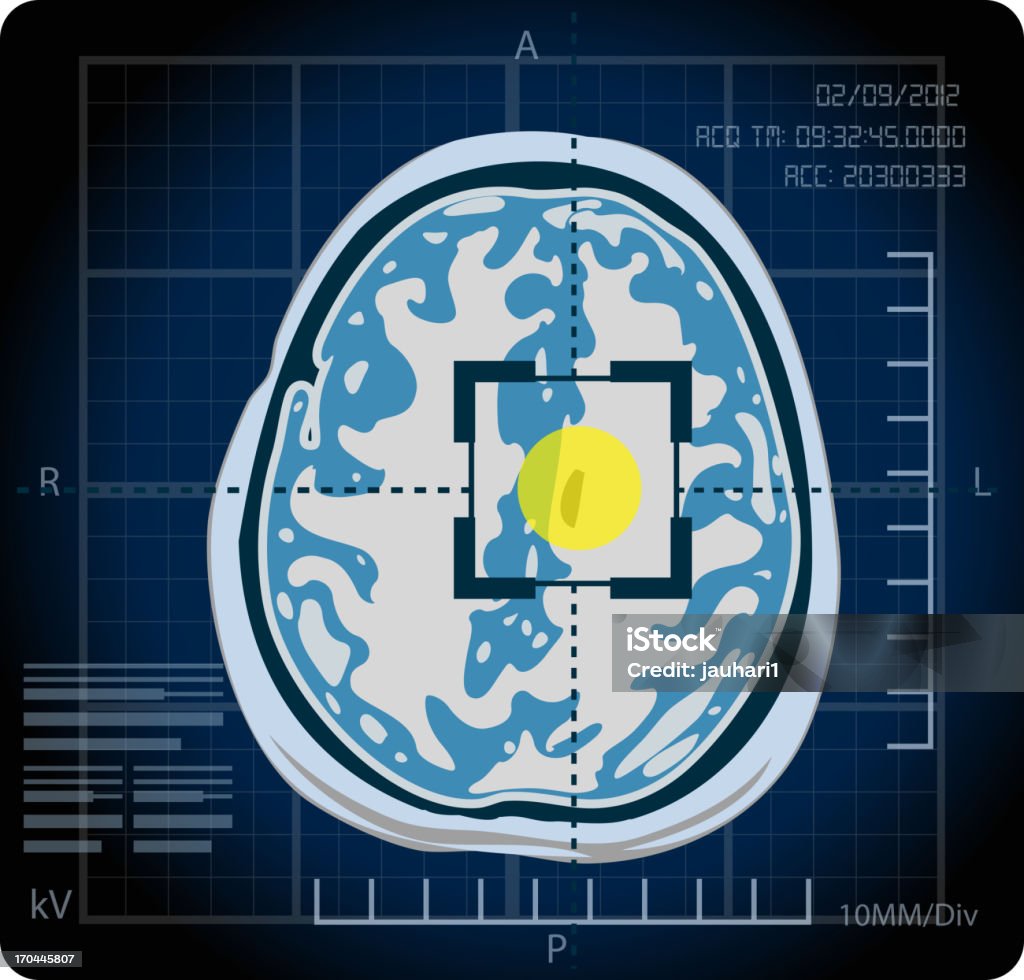 МРТ-поиска - Векторная графика Магнитно-резонансная томография роялти-фри