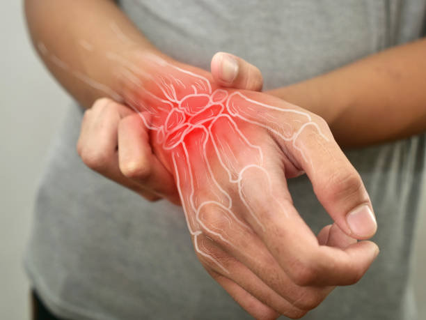 Anonymous person touching his wrist, suffering from arthritis disease stock photo