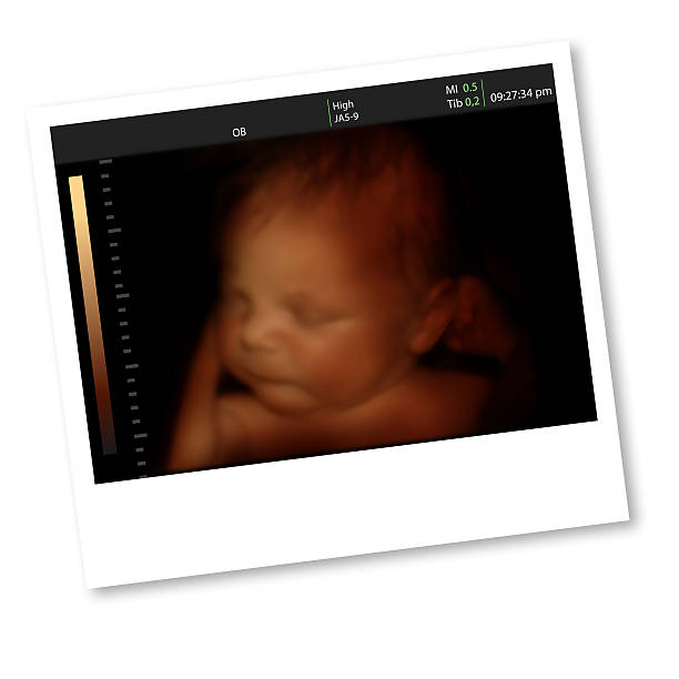 Illustration of 3D ultrasound baby in mother's womb Illustration a newborn baby (7 days old) like 3D ultrasound of baby in mother's womb. uterus photos stock pictures, royalty-free photos & images