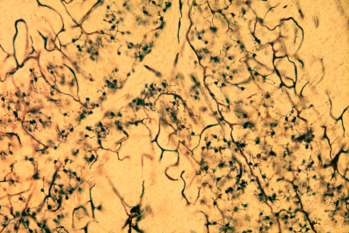 Cerebellar granule cells, light micrograph. Cerebellar granular layer stained with Golgi silver chromate showing the abundance of granule cells. They have a very small rounded soma with three to five dendrites, ending in an enlargement called a dendritic claw. The dark thick traces are blood capillaries.