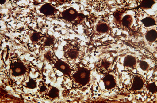 Light micrograph of autonomic sympathetic ganglion stained with Cajals silver nitrate showing a mixture of multipolar neuronal cell bodies and nerve fibres.