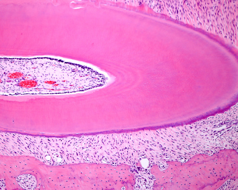 Cross section (slightly oblique) of a tooth root showing from the left border: dental pulp, row of odontoblast cell bodies, predentine, dentin, acellular cementum, periodontal ligament and alveolar bone.