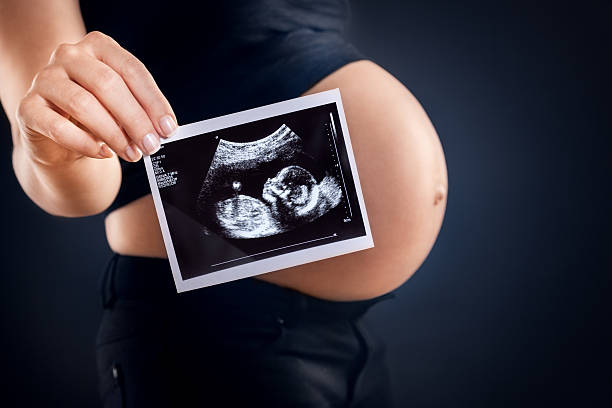 Pregnant woman holding an ultrasound image. Pregnant woman holding an ultrasound image. fetus photos stock pictures, royalty-free photos & images
