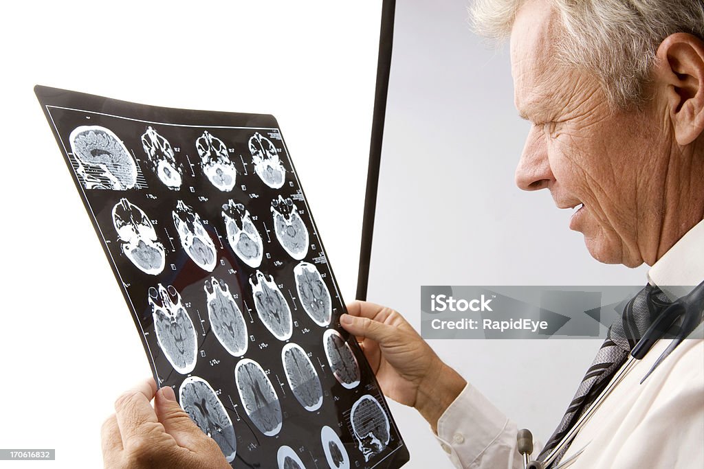 Сканирование головного мозга осмотр - Стоковые фото Нервная система человека роялти-фри