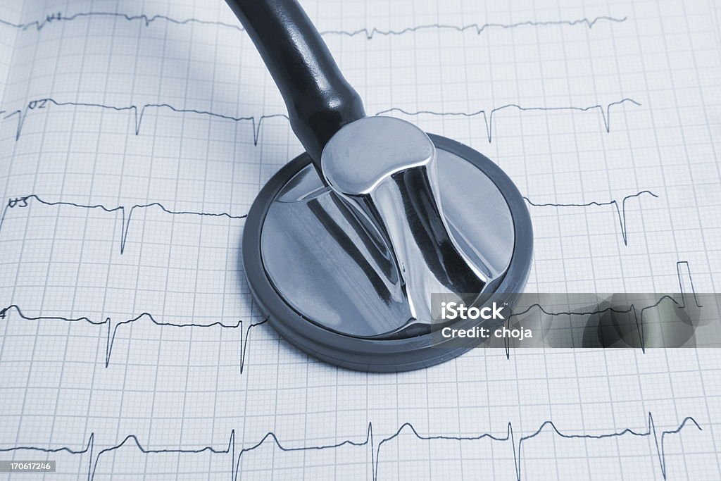 Stetoskop na badanie EKG drukowania w kolorze niebieskim - Zbiór zdjęć royalty-free (Badanie pulsu)