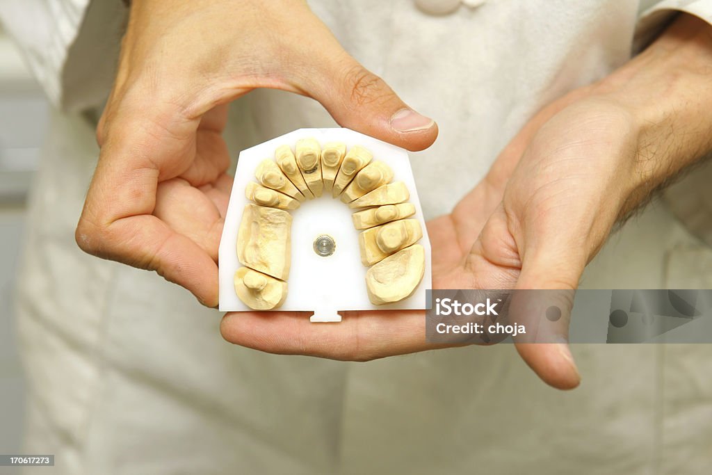 Fabbricazione di Protesi dentarie - Foto stock royalty-free di Apparecchiatura odontoiatrica