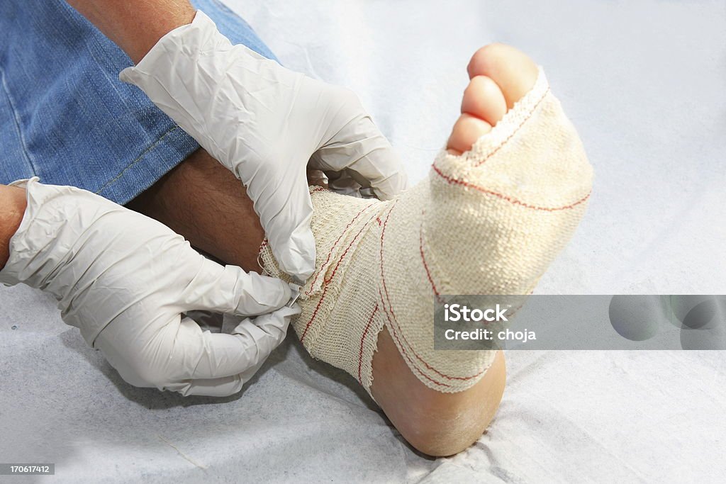 Enfermeira no trabalho, alterar rápido de feridos doentes ancle - Royalty-free Ligadura Foto de stock