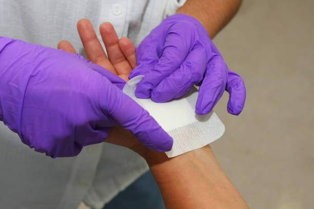 istock Patient after carpal tunnel syndrome operation at plastic surgery 170617414